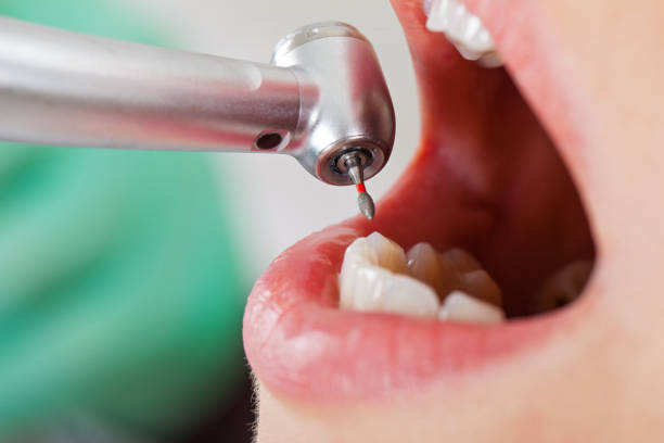 Best Emergency Dentist for Special Needs Patients in Williamston, MI